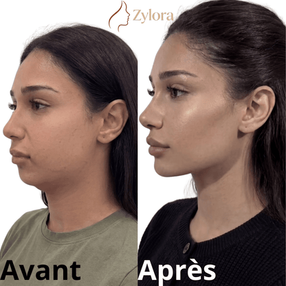 Brosse de Drainage Lymphatique Visage – Zylora - Zylora