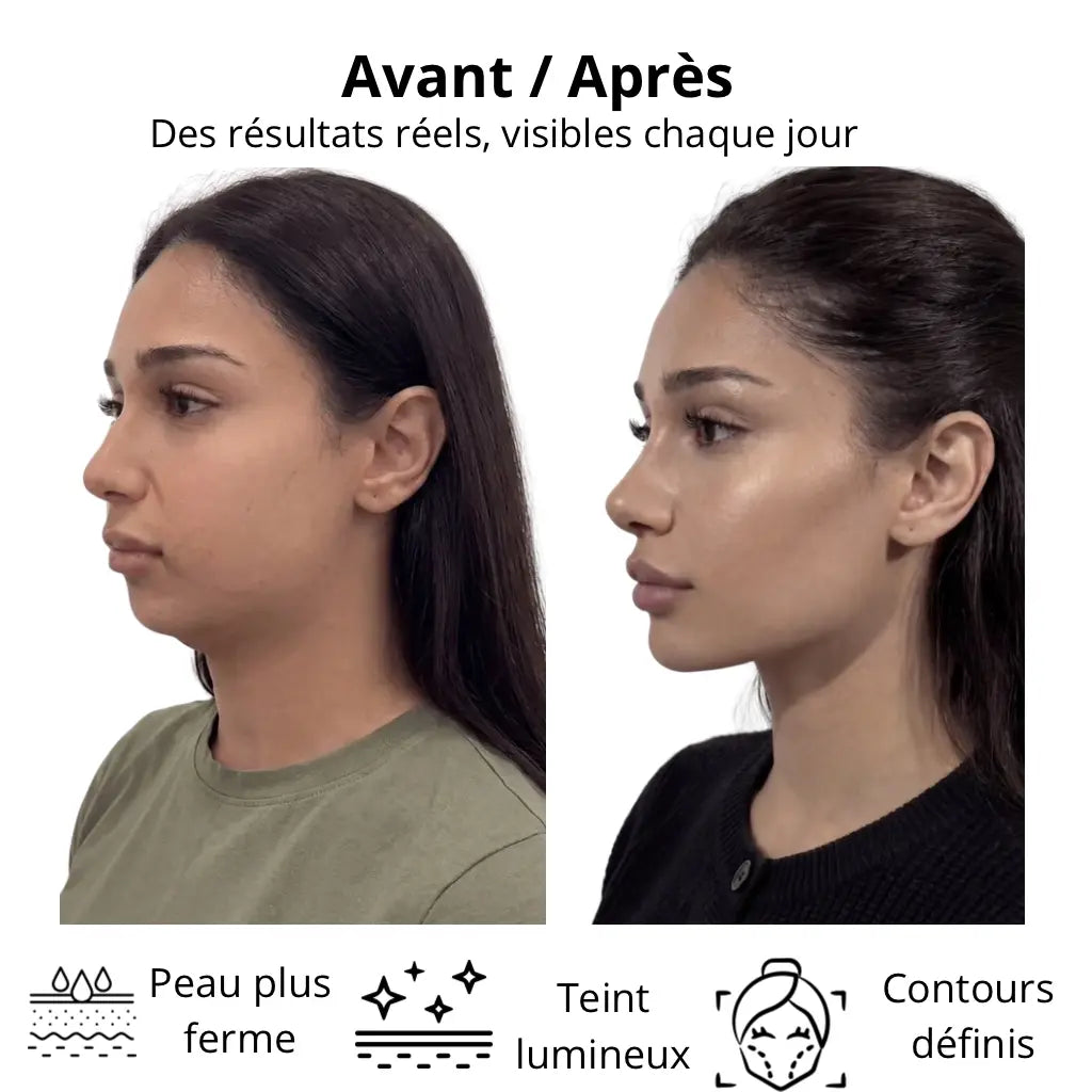 Comparaison avant/après d’une femme de profil montrant les effets d’une routine beauté avec une peau plus ferme, un teint plus lumineux et des contours du visage plus définis. Design minimaliste sur fond clair avec texte explicatif et icônes illustrant les bénéfices de Zylora 
