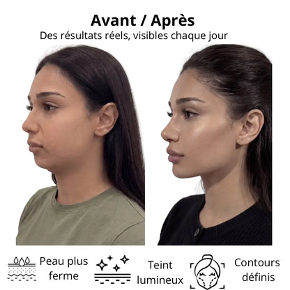Comparaison avant/après d’une femme de profil montrant les effets d’une routine beauté avec une peau plus ferme, un teint plus lumineux et des contours du visage plus définis. Design minimaliste sur fond clair avec texte explicatif et icônes illustrant les bénéfices de Zylora 